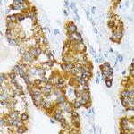 CD298 Antibody in Immunohistochemistry (Paraffin) (IHC (P))