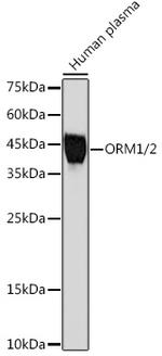 ORM1 Antibody in Western Blot (WB)