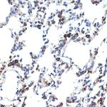 ERP29 Antibody in Immunohistochemistry (Paraffin) (IHC (P))