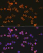 IBA1 Antibody in Immunocytochemistry (ICC/IF)