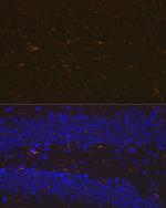 IBA1 Antibody in Immunohistochemistry (Paraffin) (IHC (P))