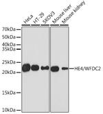 WFDC2 Antibody in Western Blot (WB)