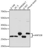 PHAPI2 Antibody in Western Blot (WB)