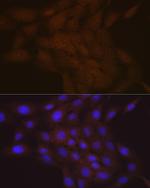 SMC4 Antibody in Immunocytochemistry (ICC/IF)