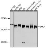 SMC4 Antibody in Western Blot (WB)