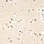 Histone H2A Antibody in Immunohistochemistry (Paraffin) (IHC (P))