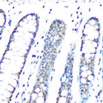 HP1 gamma Antibody in Immunohistochemistry (Paraffin) (IHC (P))