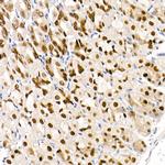 GATA4 Antibody in Immunohistochemistry (Paraffin) (IHC (P))