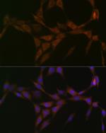 15-PGDH Antibody in Immunocytochemistry (ICC/IF)