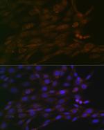 CHD3 Antibody in Immunocytochemistry (ICC/IF)