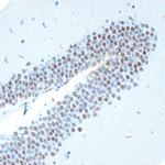 CHD3 Antibody in Immunohistochemistry (Paraffin) (IHC (P))