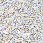 NDUFS4 Antibody in Immunohistochemistry (Paraffin) (IHC (P))
