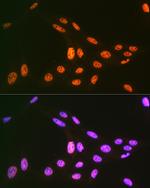 PRP19 Antibody in Immunocytochemistry (ICC/IF)