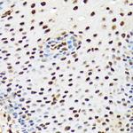 PRP19 Antibody in Immunohistochemistry (Paraffin) (IHC (P))