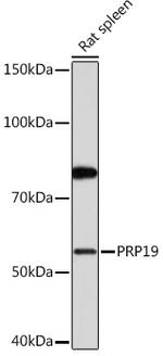 PRP19 Antibody in Western Blot (WB)