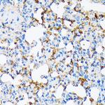 A2M Antibody in Immunohistochemistry (Paraffin) (IHC (P))