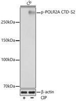 Phospho-POLR2A (Ser2) Antibody in Western Blot (WB)