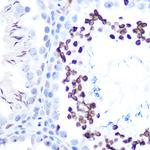 Phospho-STAT1 (Ser727) Antibody in Immunohistochemistry (Paraffin) (IHC (P))