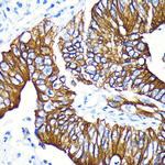 Phospho-GSK3B (Ser9) Antibody in Immunohistochemistry (Paraffin) (IHC (P))