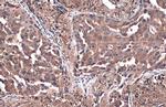 PKM Antibody in Immunohistochemistry (Paraffin) (IHC (P))