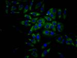 eIF4A1 Antibody in Immunocytochemistry (ICC/IF)