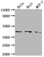 AGTR1 Antibody in Western Blot (WB)