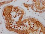 NUP98 Antibody in Immunohistochemistry (Paraffin) (IHC (P))