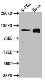 NUP98 Antibody in Western Blot (WB)