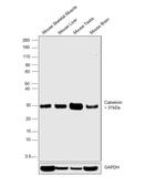 Calretinin Antibody in Western Blot (WB)