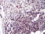 CD6 Antibody in Immunohistochemistry (Paraffin) (IHC (P))