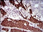 Calponin 1 Antibody in Immunohistochemistry (Paraffin) (IHC (P))