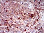 CSF1R Antibody in Immunohistochemistry (Paraffin) (IHC (P))