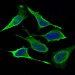 DNM1L Antibody in Immunocytochemistry (ICC/IF)