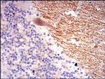 GABBR2 Antibody in Immunohistochemistry (Paraffin) (IHC (P))