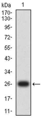 GSTP1 Antibody in Western Blot (WB)