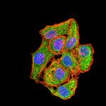 MEK3 Antibody in Immunocytochemistry (ICC/IF)