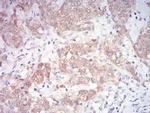 MEK3 Antibody in Immunohistochemistry (Paraffin) (IHC (P))