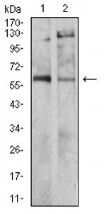 Tyrosine Hydroxylase Antibody in Western Blot (WB)