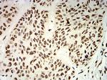 UHRF1 Antibody in Immunohistochemistry (Paraffin) (IHC (P))