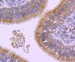 E-cadherin Antibody in Immunohistochemistry (Paraffin) (IHC (P))