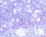 Aurora B Antibody in Immunohistochemistry (Paraffin) (IHC (P))