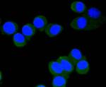 Phospho-eIF4E (Ser209) Antibody in Immunocytochemistry (ICC/IF)