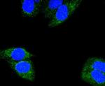 Glutaminase Antibody in Immunocytochemistry (ICC/IF)