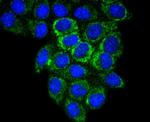 Glutaminase Antibody in Immunocytochemistry (ICC/IF)