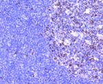 Glutaminase Antibody in Immunohistochemistry (Paraffin) (IHC (P))