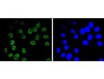 BRG1 Antibody in Immunocytochemistry (ICC/IF)