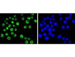 BRG1 Antibody in Immunocytochemistry (ICC/IF)