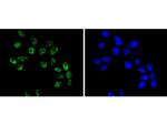 BRG1 Antibody in Immunocytochemistry (ICC/IF)