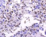 BRG1 Antibody in Immunohistochemistry (Paraffin) (IHC (P))