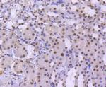 BRG1 Antibody in Immunohistochemistry (Paraffin) (IHC (P))